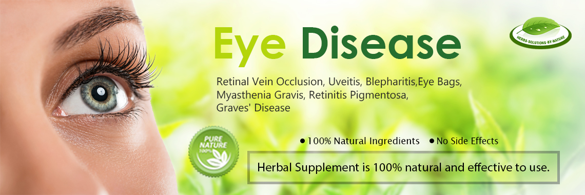 John David4 - Blogs - Herbal Remedies for Eye Diseases